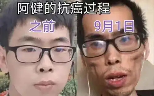 瘦骨嶙峋表情包刘兄