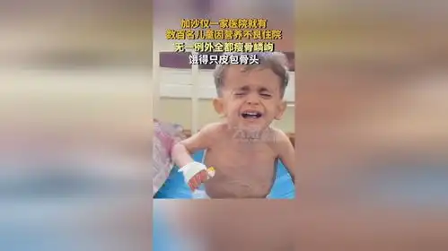 加沙仅一家医院就有数百名儿童因营养不良住院,无一例外全都瘦骨嶙峋,饿得只剩皮包骨头